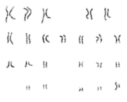 姐妹们，孕17周梦到生了一头小鹿 上海试管供卵包成功